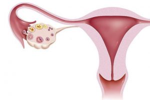 女性子宫内膜偏薄可以做试管吗？
